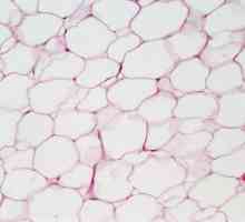 Vrste epitelnih tkiva. Epitelnih tkiva: struktura i funkcija