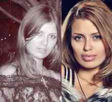 Viktoria Bonya prije i nakon plastične usne