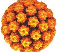 Humanim papiloma virus: simptomi, načini infekcije, dijagnostike i liječenja