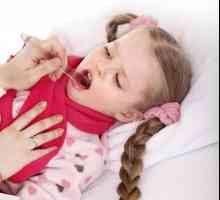 Virusne upale grla - simptomi, dijagnoze, liječenje