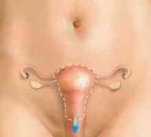 Vaginalni histerektomija - indikacije za, i njegove posljedice