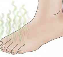Smrdljive noge - kako ukloniti miris?