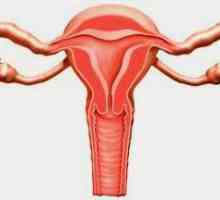 Upala jajnika: simptomi i tretman za žene, izaziva, dijagnoza