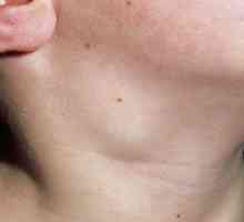 Otečene limfne čvorove na vratu djeteta: uzroci i tretman