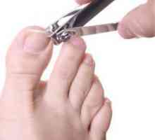 Urasta nokte: uzroci i tretmani