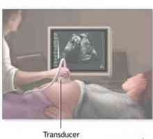 Drugi ultrazvuk tokom trudnoće na šta pojam radim? Uzi tokom trudnoće, kada i koliko puta