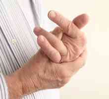 A dislocirani prst na ruci: opis i karakteristike liječenja