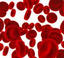 Poremećaji krvi: spisak od najopasnijih