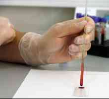 Zašto mi je potreban da se test krvi za hormona štitnjače?