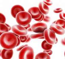 Iron anemije: Simptomi, tretman, prevencija