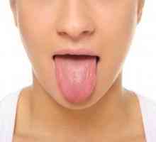 Žuta jezik premaz: uzroci i liječenje