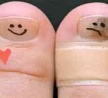 Nesretnih gljivica na nokte na nogama: tretman narodnih pravnih lijekova