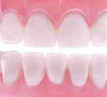 Soft proteze zub: mišljenja stručnjaka slike