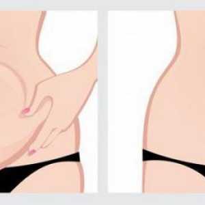 Abdominoplastika (zatezanje kože Tucks): indikacije, kontraindikacije, opis postupka, komentari