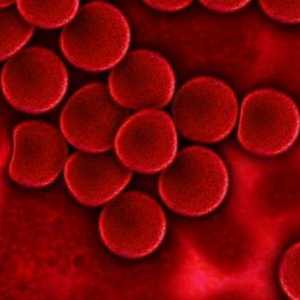 Aglutinacija krvi - to ... Krvne grupe i aglutinacija