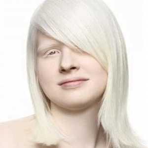 Albino - a ... Albinizam - kongenitalna odsustvo pigmenta melanina