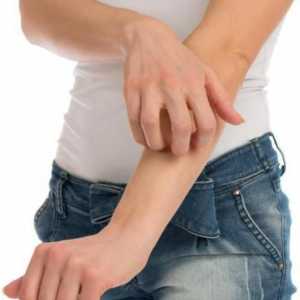 Alergija na rukama i nogama: uzroci, simptomi i karakteristike tretman