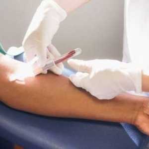 A test krvi za hepatitis