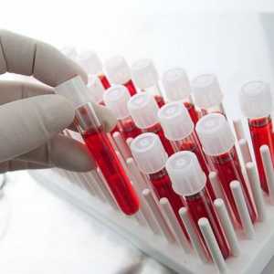 Test krvi za rak. Da li je moguće identificirati krvi rak?