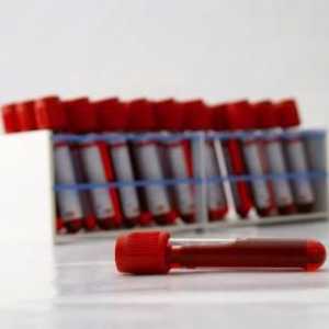 Test krvi u djeteta: transkript - da li je moguće da to uradite sami?