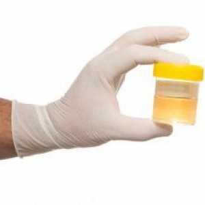 Analiza urina po Nechiporenko: kako prikupiti biološki materijal za istraživanje?