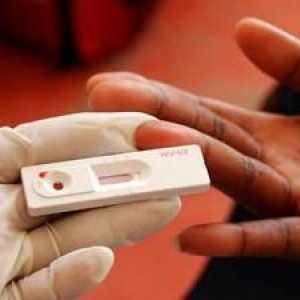 Test na HIV: smislu spremnosti, gdje i kada da se