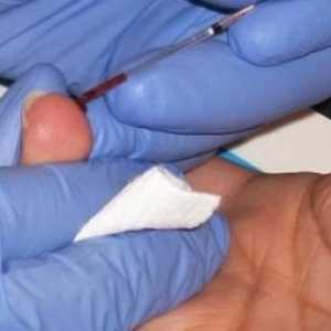 Analiza OVK i druge vrste testova krvi