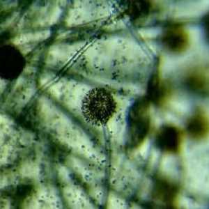Bakterije i mikrobi pod mikroskopom (slike)