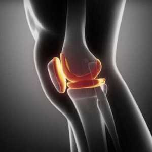 Zavoj na koleno. Ortopedskih steznik