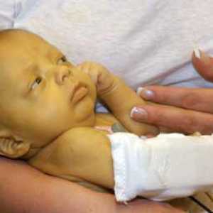 Bilirubin: normalno novorođenče. Tabela mjesečnih