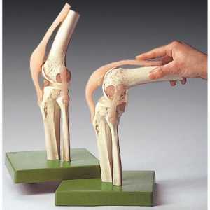 Bol u koljenu na vanjskoj strani: uzroci liječenje