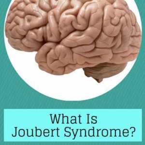 Bolest na nivou genetike - Joubert sindrom