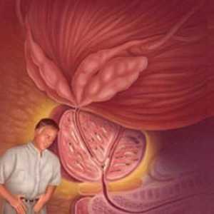 Prostate bolesti: Liječenje Drug