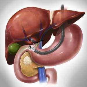 Bolesti jetre i pankreasa: simptomi, liječenje