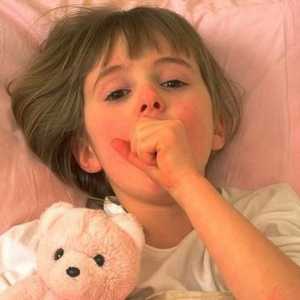 Bronhitis kod djece - nego da se tretira i kako?
