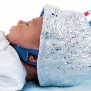 Opasnost od novorođenčeta encefalopatije?