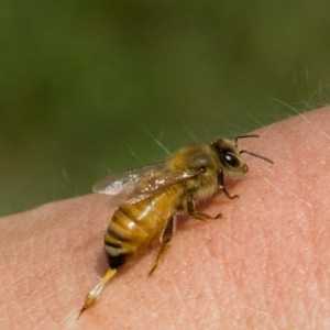 Šta da radim kada ubod pčele? za prvu pomoć