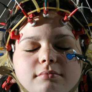 To pokazuje elektroencefalogram mozak? Toku postupka, opis, oznake i recenzije