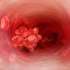 Ono što je krvni ugrušak, i koliko je to opasno?