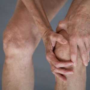 Deformacije zglob koljena artroze od 2 stepena: tretman i uzroci