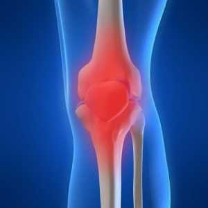 Dawa koljena: uzroci, simptomi u različitim fazama liječenja