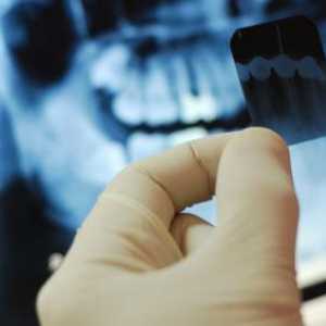 Dokumenti o porezu na odbitak za stomatološki tretman. Poreznog odbitka implantacija zuba
