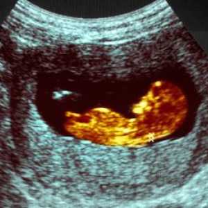 Fetometry fetus od nedjelje. fetalni veličine u nedelju