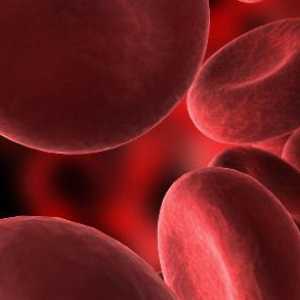 Folna kiselina anemije: uzroci, simptomi, tretman