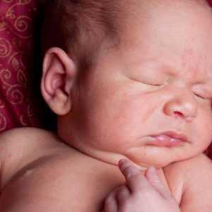 Gljiva pupka kod novorođenčadi: uzroci, liječenje, fotografije