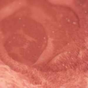 Gdje pronaći odgovor na pitanje koji je dan ovulacije javlja?