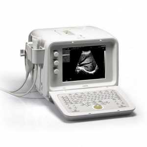 Gde ultrazvuk? izbor bolnice