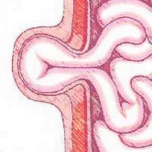 Abdominalna hernija: njihova simptomi i liječenje