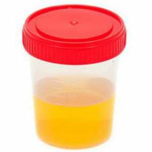 Kemijske i toksikološka ispitivanja urina