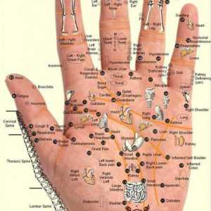 Akupunktura u osteohondroze vratne kralježnice: Komentari doktora i pacijenata